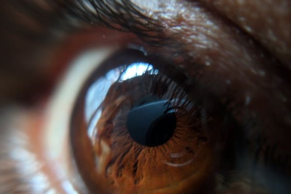 Close up of clear eyes reflecting light in a dark room